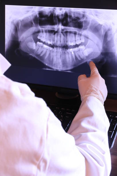 Best Emergency Tooth Extraction in Oologah, OK