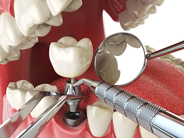 Best Weekend Emergency Dentist in Oologah, OK